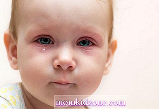 Kategorija kūdikis: 
 Naujagimio akių išmetimas - priežastys ir sprendimai