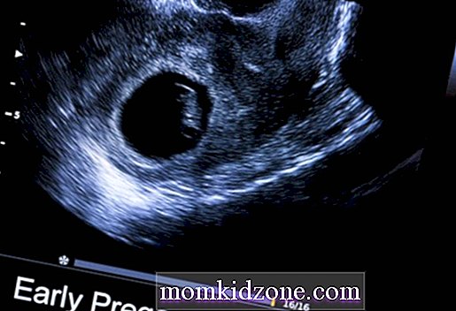 presnosť tehotenstva ultrazvuk datovania prvé správy online datovania príklady