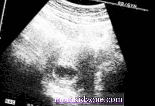 7 tjedana trudnoće skeniranja b2 stranica za upoznavanje uk