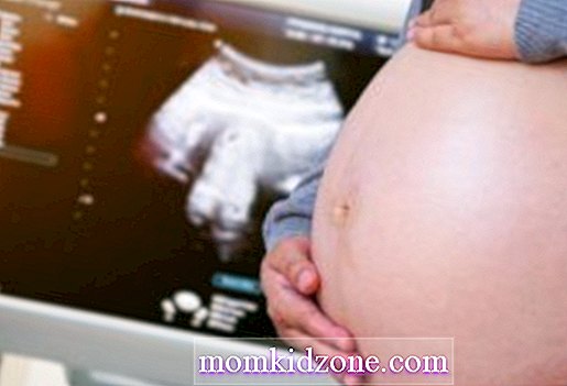 datira na ultrazvučnu trudnoću kuda idete da priključite izvor napajanja u ubojici 3