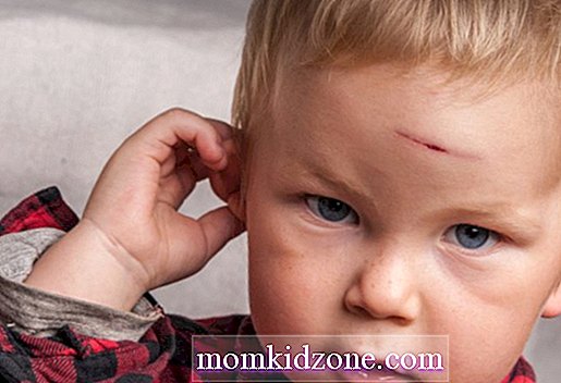 إصابة الرأس في الأطفال أنواع أعراض وعلاج طفل صغير 2021